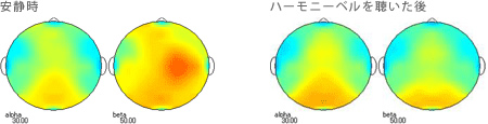 <被験者 1>　ハーモニーベルCDを聴く前の安静時と聴いた後の脳波 38歳男性の場合
