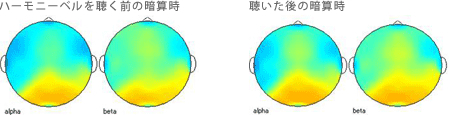 <被験者 2>　ハーモニーベルCDを聴くと聴いた後の暗算計算時の脳波 35歳女性の場合