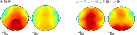 <被験者 1>　2ヶ月間毎日ハーモニーベルCDを聴いた後、実験時にハーモニーベルCDを聴く前の安静時と聴いた後の脳波 38歳男性の場合