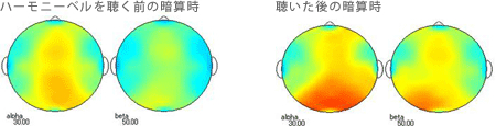 <被験者 1>　2ヶ月間毎日ハーモニーベルCDを聴いた後、ハーモニーベルCDを聴く前と聴いた後の暗算計算時の脳波 38歳男性の場合