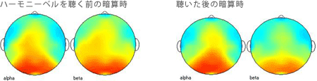 <被験者 2>　2ヶ月間毎日ハーモニーベルCDを聴いた後、ハーモニーベルCDを聴く前と聴いた後の暗算計算時の脳波 35歳女性の場合