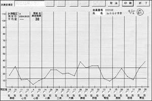 被験者A（35才女性）の経絡電位測定結果