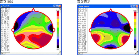 【マッピングによる左右差の検討